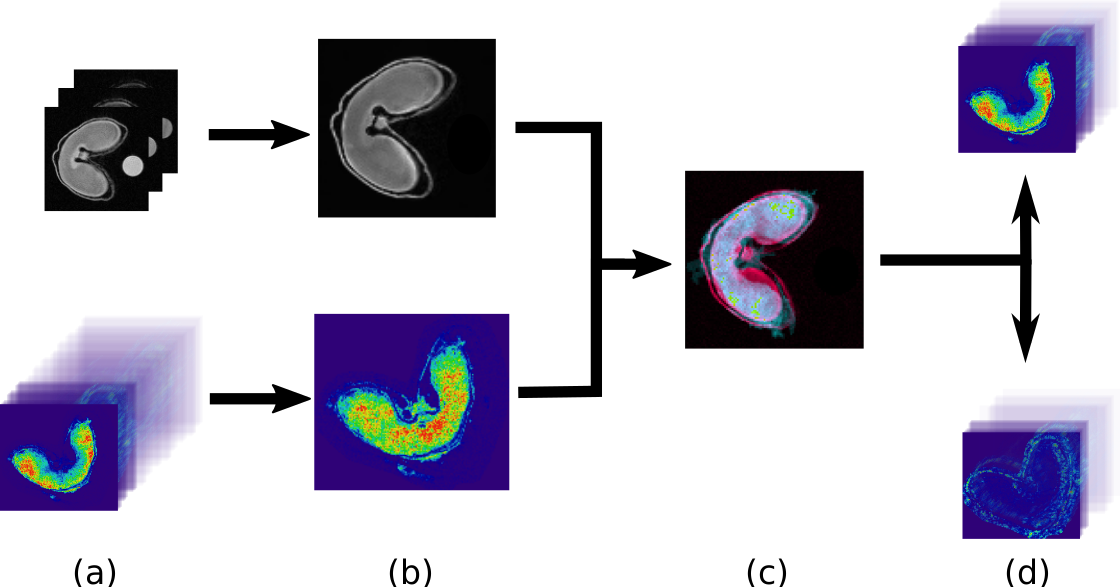 Image fusion workflow achieved by Esmraldi